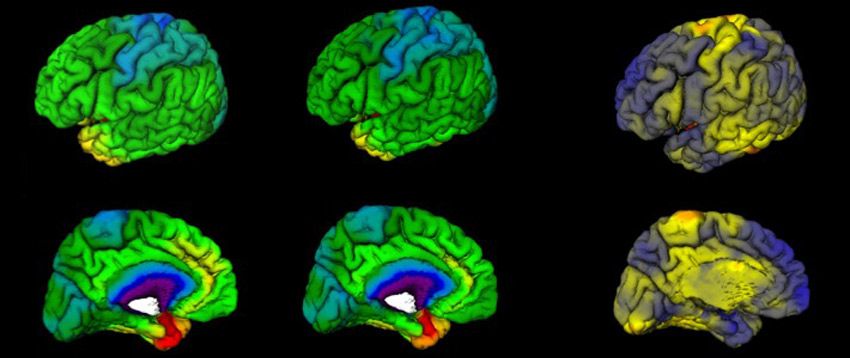 Diagnosi precoce e decisioni tempestive per curare cuore e cervello